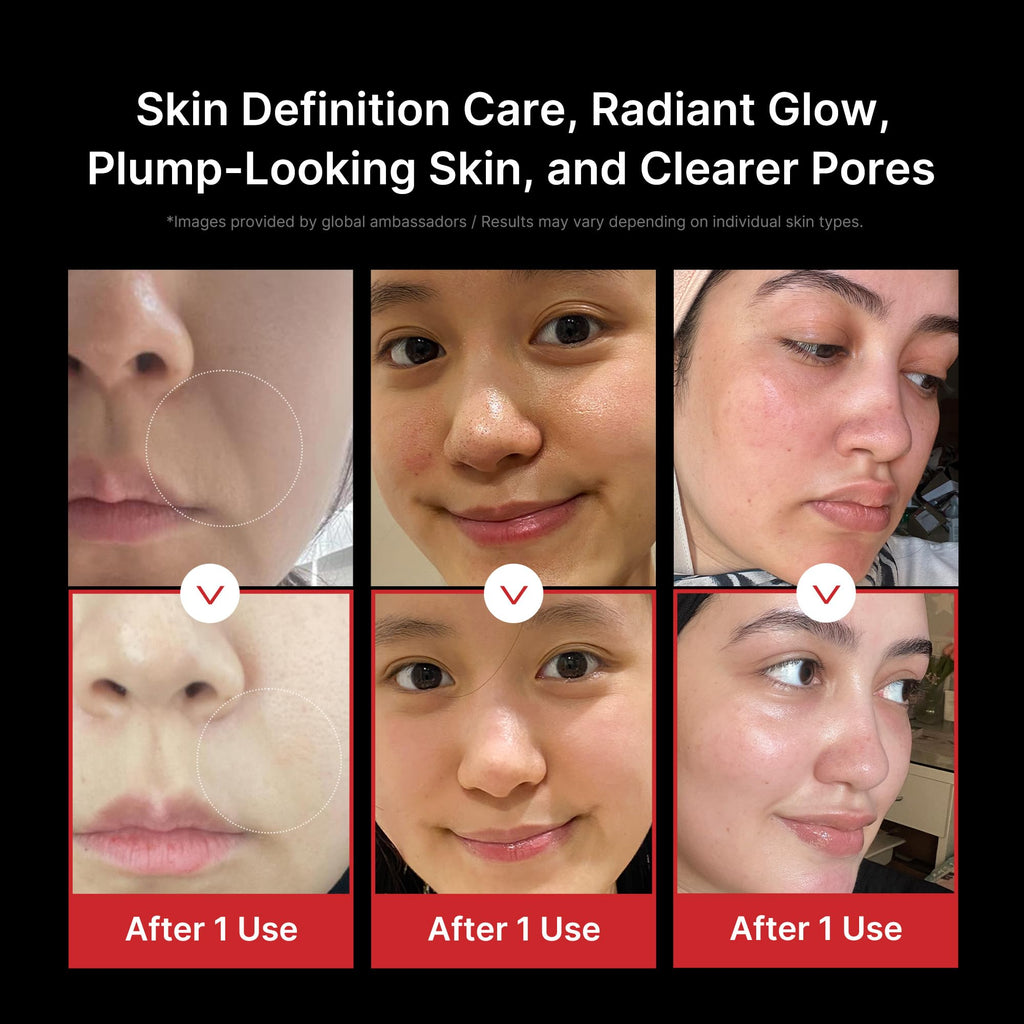 Appareil de soin visage Age-R Booster Pro 6-en-1 massage beauté noir raffermissant hydratant avec technologie de soin coréen