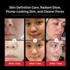 Appareil de soin visage Age-R Booster Pro 6-en-1 massage beauté noir raffermissant hydratant avec technologie de soin coréen