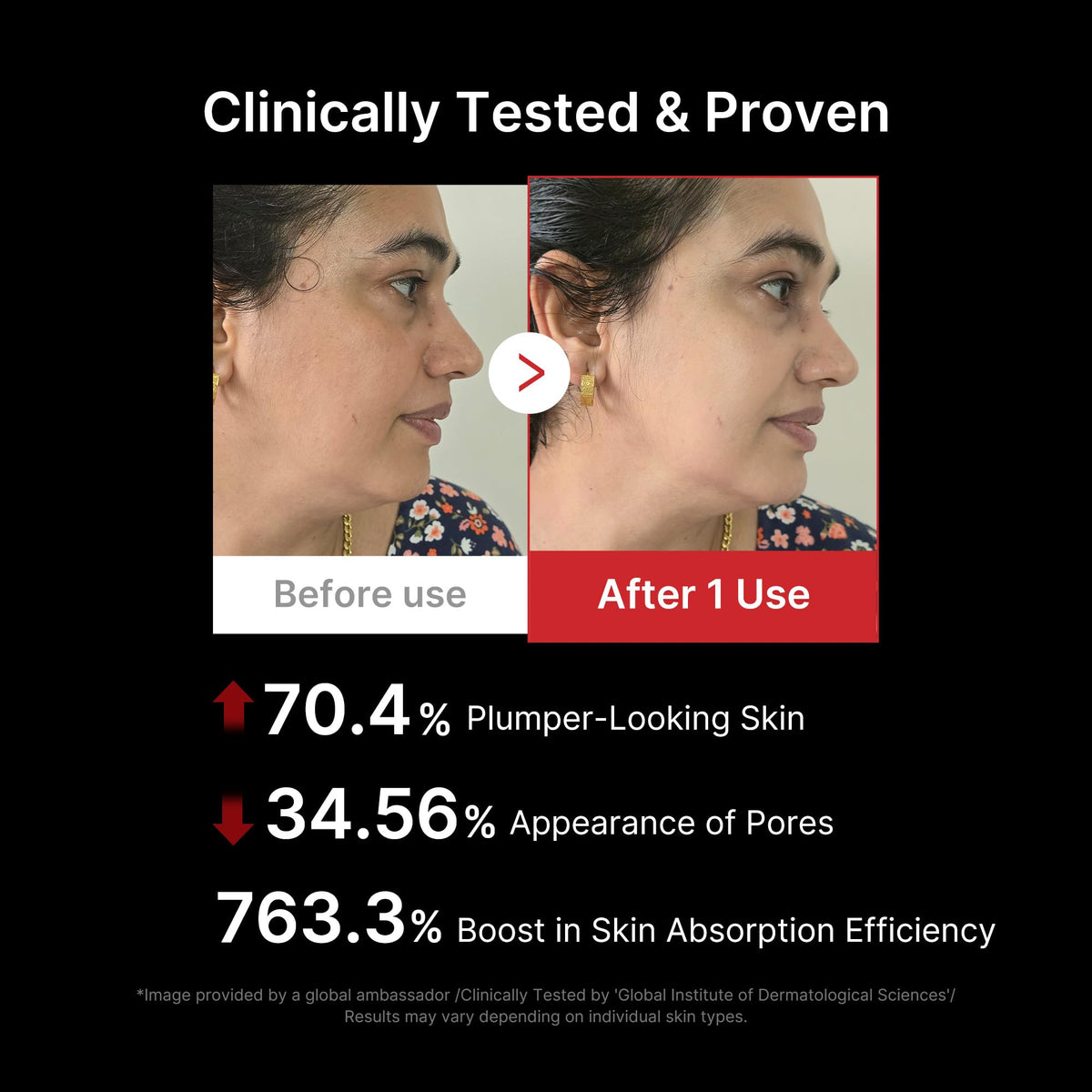 Appareil de soin visage Age-R Booster Pro 6-en-1 massage beauté noir raffermissant hydratant avec technologie de soin coréen